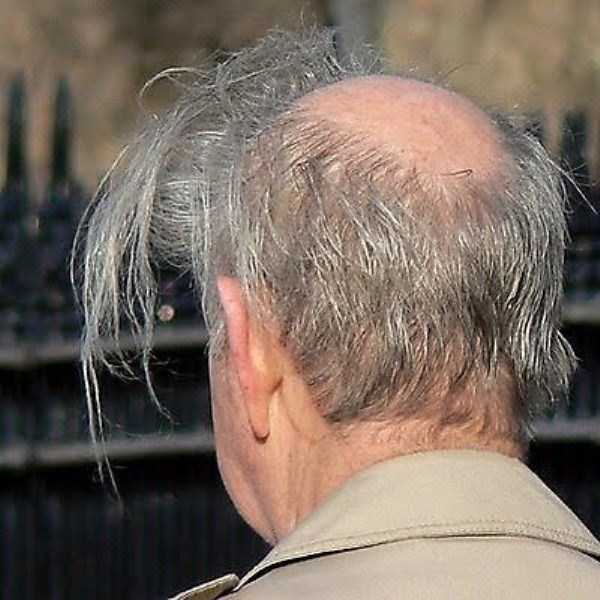 bald-men-15