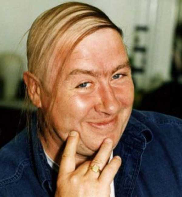 bald-men-25