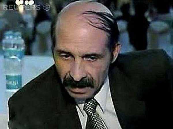 bald-men-8