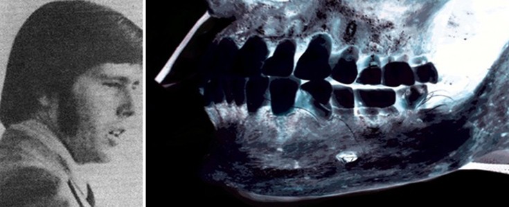 fforoeennssiivcsc4a