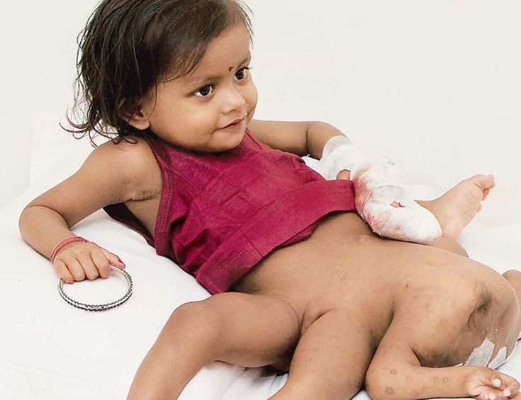bihar-girl-2-650_011415070954.jpg