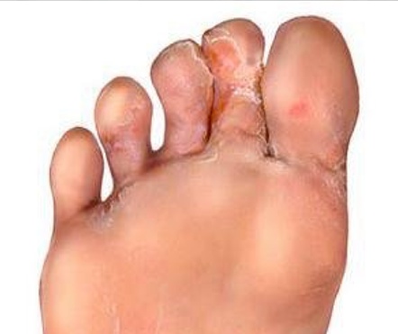 6329