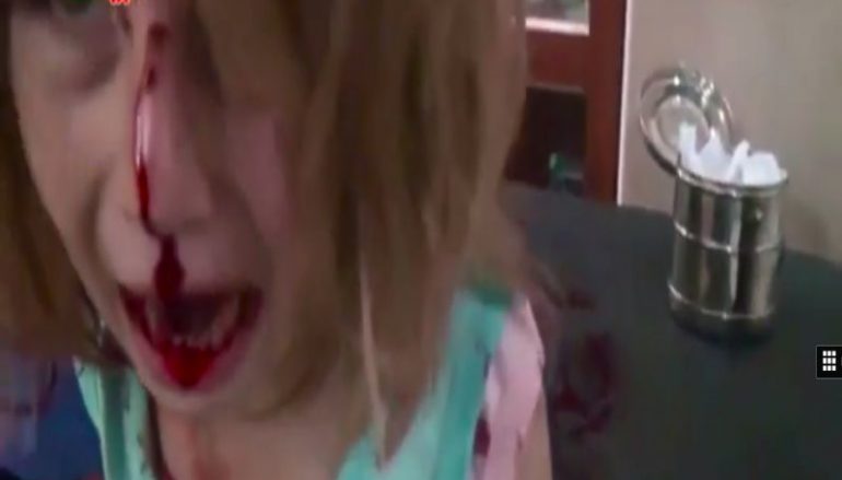 Ραγίζει καρδιές η μικρή Αya από τη Συρία- Μέσα στα αίματα κλαίει και ζητάει τον μπαμπά της (video)