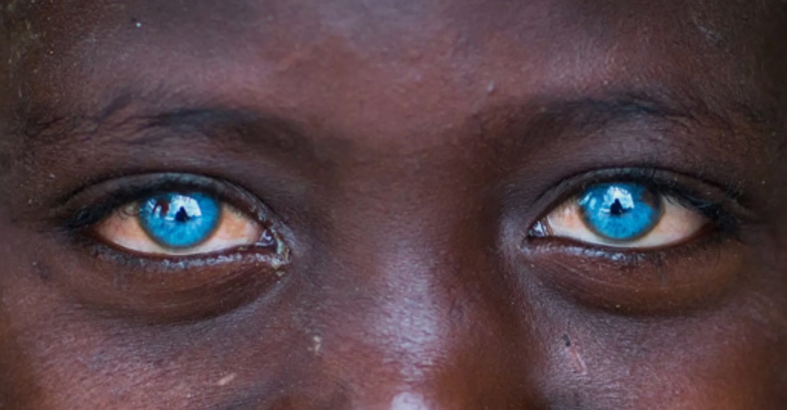 To αγόρι με τα πιο όμορφα μπλε μάτια του πλανήτη (photos)