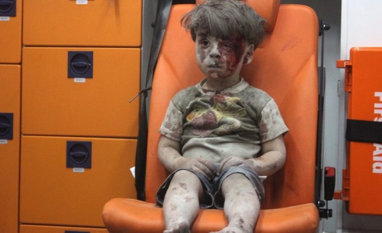 Ετσι είναι σήμερα το αγοράκι που έγινε σύμβολο του πολέμου στην Συρία -Ηταν μέσα στα αίματα, με το βλέμμα χαμένο – BINTEO