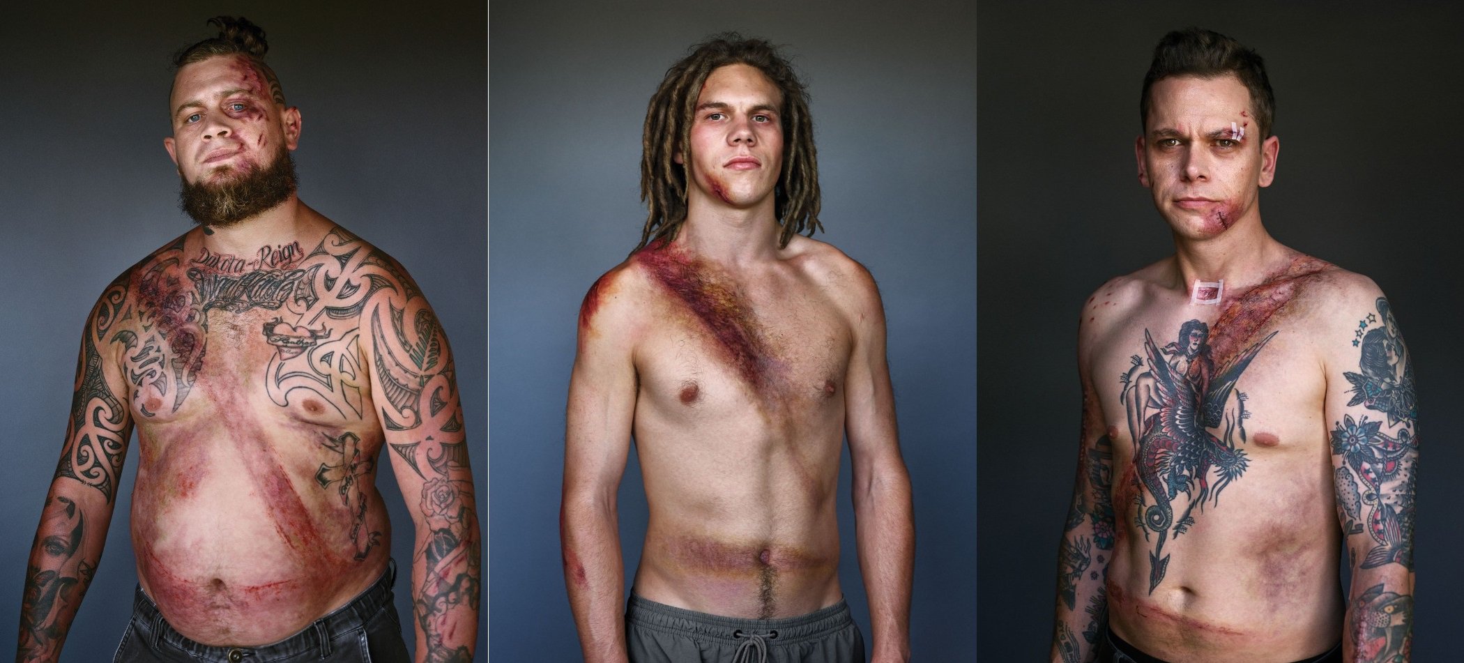 Οι σοκαριστικές φωτογραφίες 10 ανθρώπων που (ευτυχώς) φορούσαν ζώνη