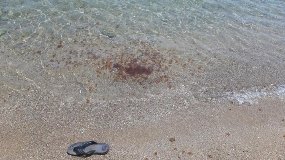 ΠΡΟΣΟΧΗ:  Μέδουσες εμφανίστηκαν στα ανατολικά παράλια της Κύπρου (ΦΩΤΟ)