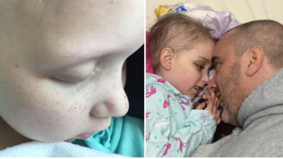 Πατέρας φωτογράφησε την τελευταία βλεφαρίδα της κόρης του που έπασχε από καρκίνο (ΦΩΤΟ)