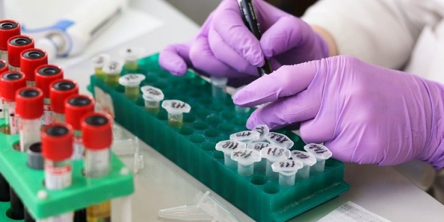 Νέα έρευνα: Ποια ομάδα αίματος κινδυνεύει λιγότερο να κολλήσει τον ιό