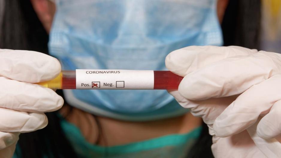 Έτσι διαγνώστηκα με κορωνοϊό όταν επέστρεψα από την Αγγλία (ΒΙΝΤΕΟ)
