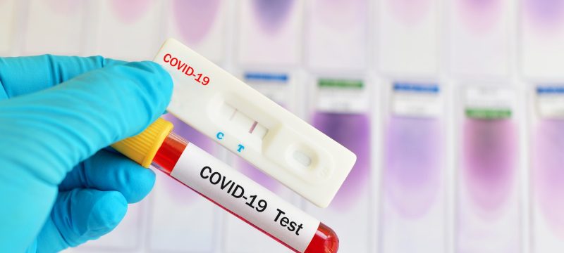 COVID-19-RT-KV.jpg