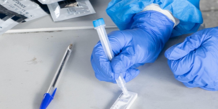 Αυτά είναι τα σημεία για tapid test σήμερα 26 Δεκεμβρίου