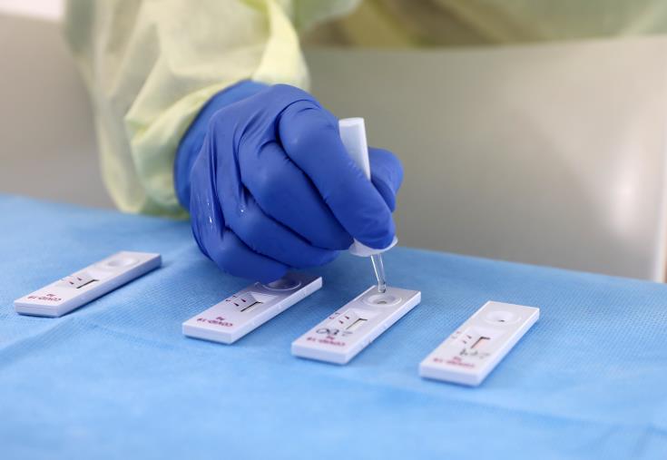 Εννέα σημεία για rapid tests την Παρασκευή στη Λάρνακα