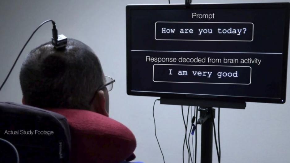 Πρώτη φορά βουβός μπορεί να «μιλήσει» χάρη στην τεχνητή νοημοσύνη