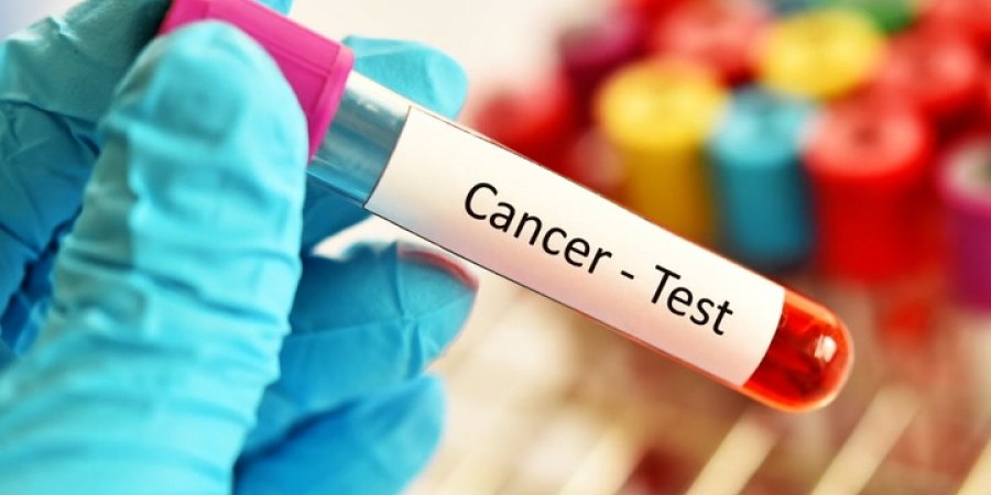 Βρετανία: Αρχίζει η δοκιμή τεστ αίματος για ανίχνευση ειδών καρκίνου