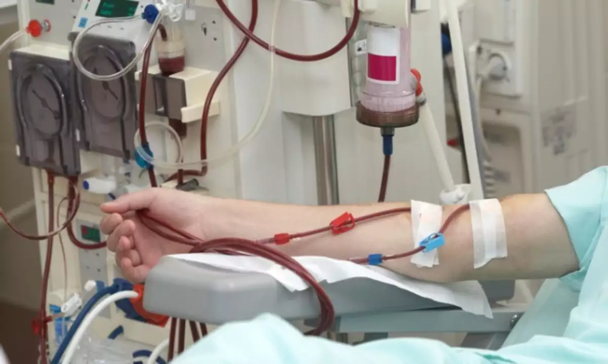dialysis-health-care-medicine-kidney-picture-id493762819