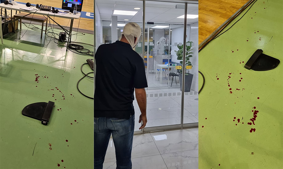 Πιάσαμε πάτο – Άνανδρη επίθεση σε δημοσιογράφο που αιμορραγούσε και μεταφέρθηκε σε κλινική (photos)