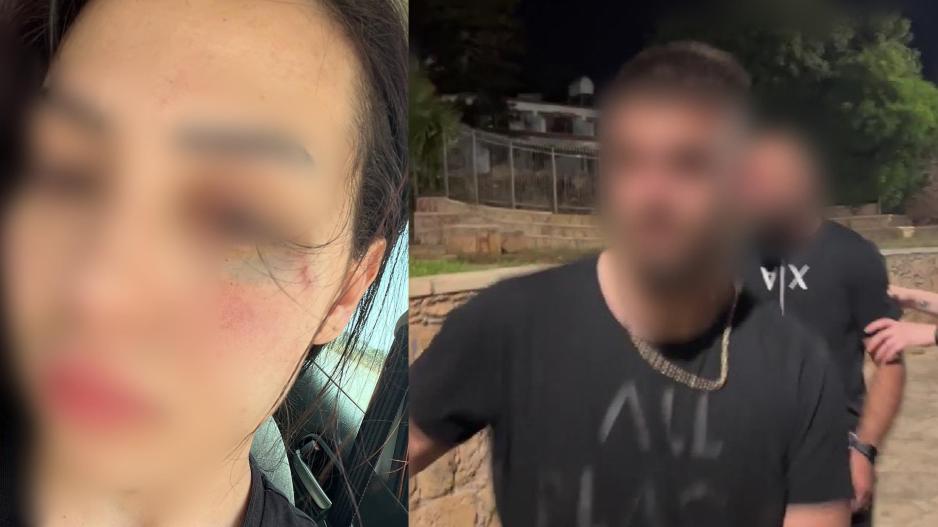 «Δεν θέλω ο ξυλοδαρμός μου να φέρει ένταση κι εχθρότητα στις δύο κοινότητες»
