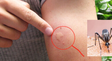 images_man-biting-mosquito