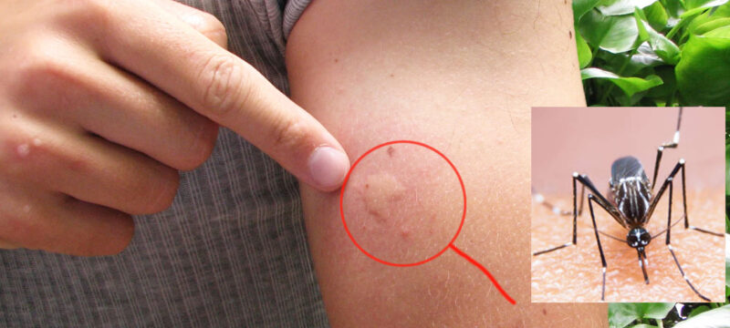 images_man-biting-mosquito