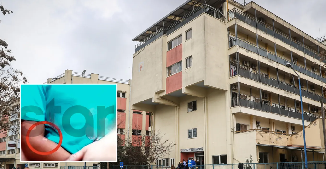 Κακοποιημένα αδελφάκια από καψίματα στη Λάρισα – 32χρονη Κύπρια η μάνα