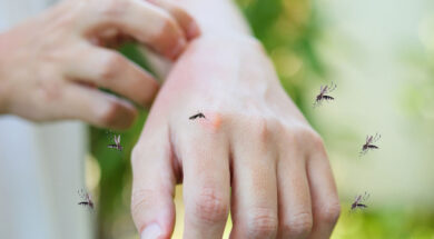 78d512f3-bigstock-Man-Itching-And-Scratching-On-461838745