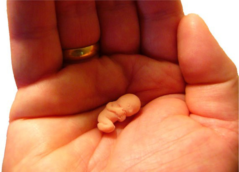 «Τεράστια νίκη»: Οι Eυρωβουλευτές στηρίζουν πρωτοβουλία πολιτών για προσβάσιμη άμβλωση