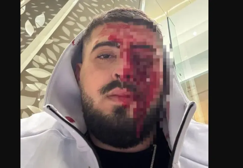 Ανατροπή στην υπόθεση Ισραηλινού: «Συμπλοκή με ομοεθνείς του, όχι ξυλοδαρμός»