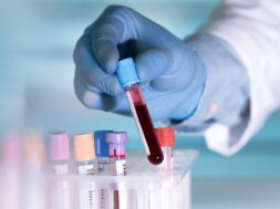 73b5b17b7aab79fdde21b3646db9d3c1