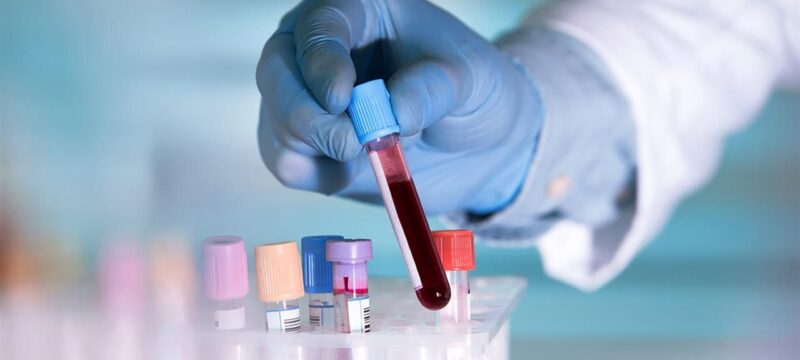 73b5b17b7aab79fdde21b3646db9d3c1