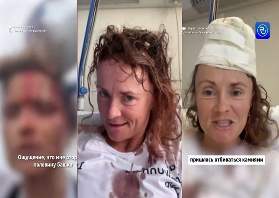 Ρωσίδα αθλήτρια δέχθηκε άγρια επίθεση από σκύλους στην Κύπρο (ΒΙΝΤΕΟ)