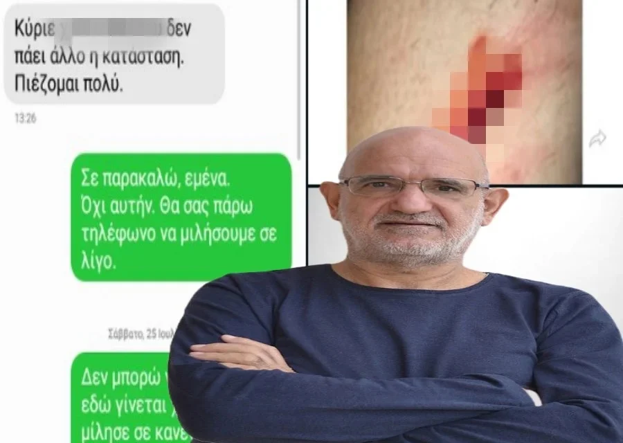 Σε γερμανική ιστοσελίδα η φωτογραφία με την πληγή στο χέρι της Σάντυ  (φώτο)