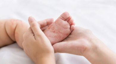 measles_ilara_1391758724-768×432